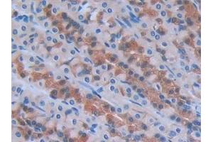 Detection of IL6 in Rat Stomach Tissue using Monoclonal Antibody to Interleukin 6 (IL6)