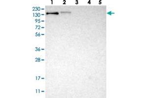 Western blot analysis of Lane 1: RT-4, Lane 2: U-251 MG, Lane 3: Human Plasma, Lane 4: Liver, Lane 5: Tonsil with LRIG2 polyclonal antibody . (LRIG2 anticorps)
