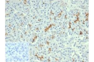 Formalin-fixed, paraffin-embedded human pancreas stained with CFTR Recombinant Mouse Monoclonal Antibody (rCFTR/6476). (CFTR anticorps  (AA 258-385))