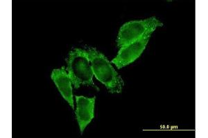 Immunofluorescence of monoclonal antibody to MMP9 on HeLa cell.