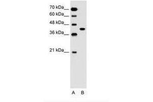 Image no. 1 for anti-Solute Carrier Family 35, Member B1 (SLC35B1) (AA 288-337) antibody (ABIN205013) (SLC35B1 anticorps  (AA 288-337))