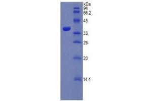 SDS-PAGE analysis of Rat PST Protein. (SULT1A1 Protéine)