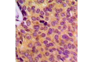 anti-MOB Kinase Activator 3B (MOB3B) (Center) antibody