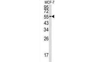 Western Blotting (WB) image for anti-Eukaryotic Translation Elongation Factor 1 alpha 1 (EEF1A1) antibody (ABIN3002705)