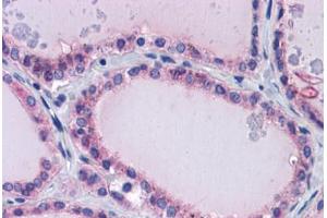 Human Thyroid: Formalin-Fixed, Paraffin-Embedded (FFPE)