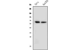 Western blot analysis of NFIA using anti-NFIA antibody (ABIN6719349).