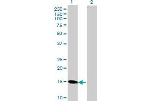Western Blot analysis of RCAN1 expression in transfected 293T cell line by RCAN1 MaxPab polyclonal antibody.