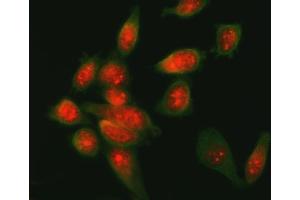 IF analysis of ATF6 using anti-ATF6 antibody (ABIN7602466) and anti-Beta Tubulin antibody (ABIN7602743). (ATF6 anticorps  (AA 79-670))