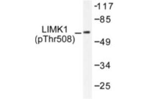 Image no. 1 for anti-LIM Domain Kinase 1 (LIMK1) (pThr508) antibody (ABIN318062) (LIM Domain Kinase 1 anticorps  (pThr508))