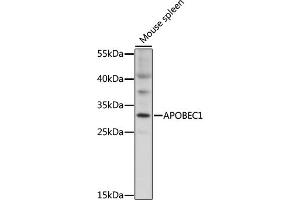 Western blot analysis of extracts of mouse spleen, using  antibody (ABIN7265636) at 1:1000 dilution.