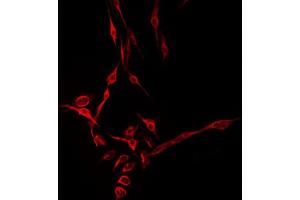 ABIN6275010 staining HepG2 by IF/ICC.