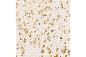 Immunohistochemistry of paraffin embedded mouse brain using Neurokinin-A (ABIN7075824) at dilution of 1:1100 (400x lens)