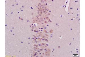 anti-Basic Helix-Loop-Helix Domain Containing, Class B, 9 (BHLHB9) (AA 451-547) antibody