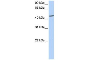 ICA1 antibody used at 1 ug/ml to detect target protein. (ICA1 anticorps  (C-Term))