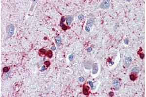 Brain, cortex, Human: Formalin-Fixed, Paraffin-Embedded (FFPE) (CRYAB anticorps)