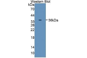 Detection of Recombinant C8a, Mouse using Polyclonal Antibody to Complement Component 8a (C8a) (C8A anticorps  (AA 21-300))