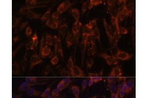 Immunofluorescence analysis of C6 cells using TLR3 Polyclonal Antibody at dilution of 1:100. (TLR3 anticorps)