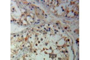 Used in DAB staining on fromalin fixed paraffin-embedded Testis tissue