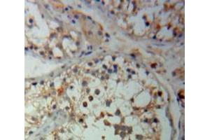Used in DAB staining on fromalin fixed paraffin-embedded Testis tissue (Hexokinase 2 anticorps  (AA 469-669))