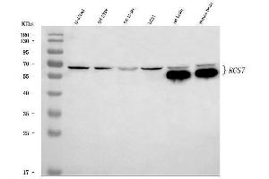 Western blot analysis of RGS7 using anti-RGS7 antibody (ABIN7599430).