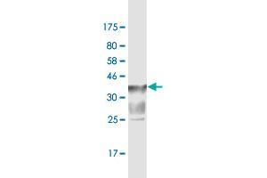 Western Blot detection against Immunogen (37. (SLC44A2 anticorps  (AA 123-230))