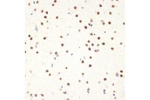 Immunohistochemistry of paraffin-embedded rat brain using N Rabbit mAb (ABIN7268774) at dilution of 1:100 (40x lens). (NAT10 anticorps)
