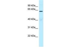 Image no. 1 for anti-Myotubularin Related Protein 6 (MTMR6) (AA 531-580) antibody (ABIN6747841) (MTMR6 anticorps  (AA 531-580))