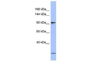 WB Suggested Anti-PSMD1 Antibody Titration: 0. (PSMD1 anticorps  (N-Term))