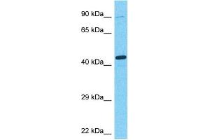 Host:  Rabbit  Target Name:  ARFP2  Sample Type:  Fetal Kidney lysates  Antibody Dilution:  1. (ARFIP2 anticorps  (C-Term))
