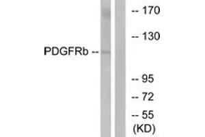 Western Blotting (WB) image for anti-Platelet Derived Growth Factor Receptor beta (PDGFRB) (AA 718-767) antibody (ABIN2889053) (PDGFRB anticorps  (AA 718-767))
