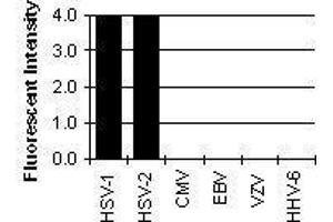 Cross Reactivity Results determined by IFA (HSV gB anticorps)