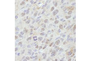 Immunohistochemistry (IHC) image for anti-Protein Phosphatase, Mg2+/Mn2+ Dependent, 1G (PPM1G) (AA 400-450) antibody (ABIN7448735)