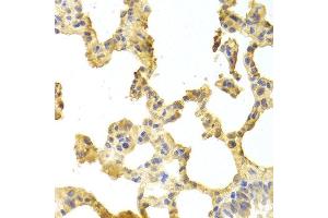 Immunohistochemistry of paraffin-embedded rat lung using TRAF2 antibody at dilution of 1:100 (x400 lens). (TRAF2 anticorps)