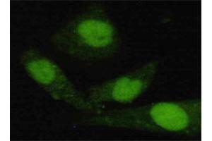 Immunofluorescence staining of HeLa cells using JARID1C monoclonal antibody  at 1:200 dilution. (KDM5C anticorps  (C-Term))