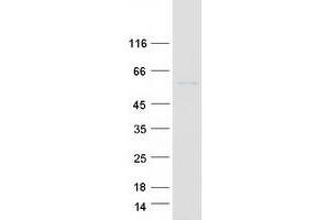 Validation with Western Blot