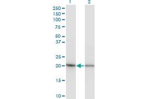 Western Blot analysis of RPS5 expression in transfected 293T cell line by RPS5 monoclonal antibody (M02), clone 4H3.