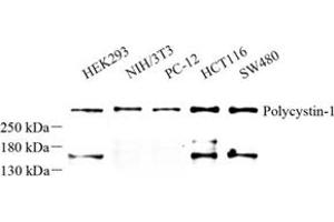 Western blot analysis of Polycystin-1 (ABIN7075124) at dilution of 1: 500 (PKD1 anticorps)