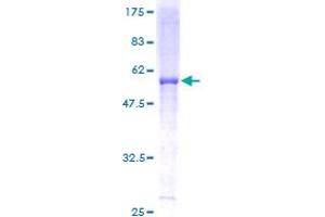 UQCRFS1 Protein (AA 1-274) (GST tag)