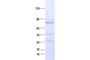 Validation with Western Blot