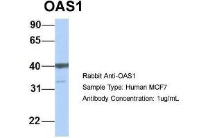 Host: Rabbit  Target Name: OAS1  Sample Tissue: Human MCF7  Antibody Dilution: 1. (OAS1 anticorps  (C-Term))