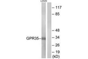 Western blot analysis of extracts from LOVO cells, using GPR35 Antibody.