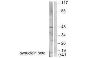 Western blot analysis of extracts from HeLa cells, using Synuclein β antibody. (beta Synuclein anticorps)