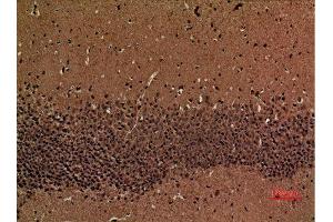 Immunohistochemistry (IHC) analysis of paraffin-embedded Mouse Brain, antibody was diluted at 1:100. (CAMK2D anticorps  (Internal Region))