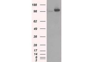 Image no. 2 for anti-Hexokinase 2 (HK2) antibody (ABIN1498647) (Hexokinase 2 anticorps)