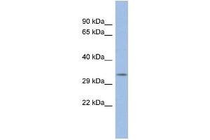 WB Suggested Anti-POU5F2 Antibody Titration: 0. (POU5F2 anticorps  (N-Term))