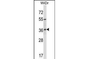 RIBC2 Antibody (N-term) (ABIN657503 and ABIN2846528) western blot analysis in WiDr cell line lysates (35 μg/lane). (RIBC2 anticorps  (N-Term))