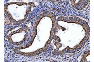 IHC analysis of NDUFS6 using anti-NDUFS6 antibody (ABIN7599568).