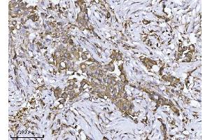 IHC analysis of SCA2/ATXN2 using anti-SCA2/ATXN2 antibody (ABIN7599900). (Ataxin 2 anticorps  (AA 1278-1313))