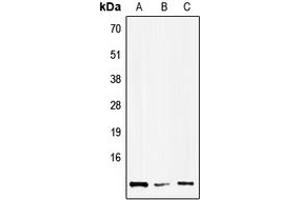 Western blot analysis of HMGN1 expression in Hela (A), NIH3T3 (B), H9C2 (C) whole cell lysates. (HMGN1 anticorps  (Center))