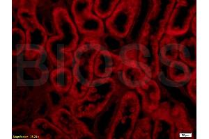 Formalin-fixed and paraffin embedded rat kidney labeled with Anti-Integrin Î±E2 Polyclonal Antibody, Unconjugated (ABIN678758) at 1:200 followed by conjugation to the secondary antibody Goat Anti-Rabbit IgG, PE conjugated used at 1:200 dilution for 40 minutes at 37 °C. (Integrin, alpha E2 (AA 1101-1179) anticorps)